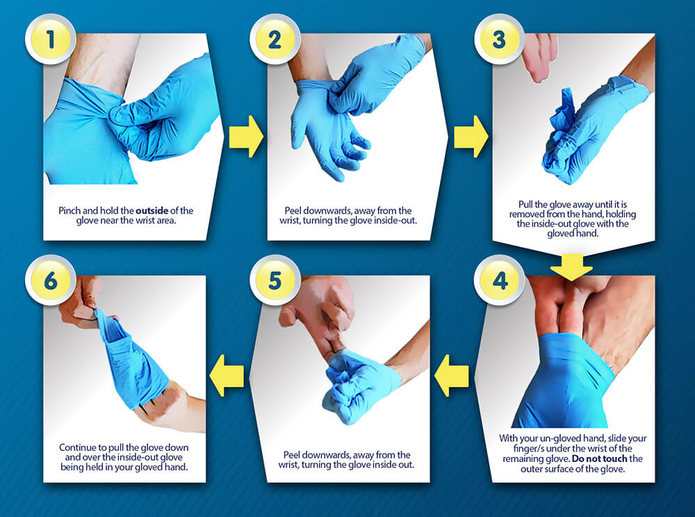 Glove procedure